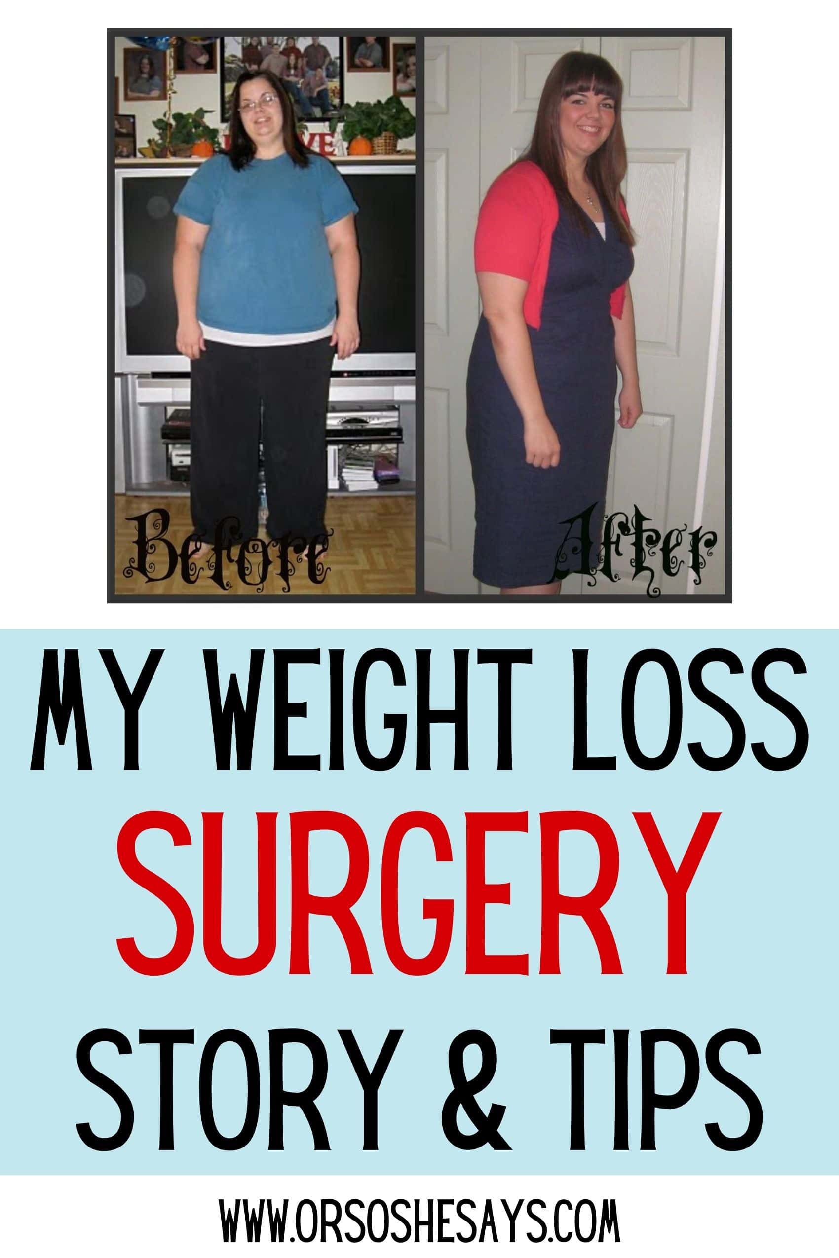 My Weight Loss Surgery Patient Story And Tips Or So She Says 4277