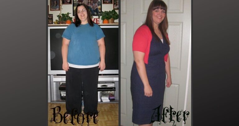 My Weight Loss Surgery Patient Story and Tips